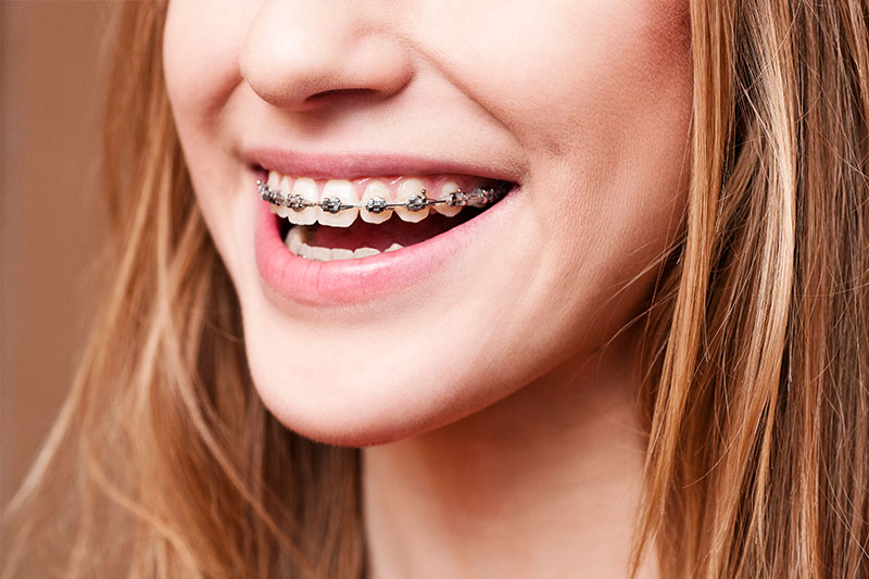 Orthodontics in Palmdale